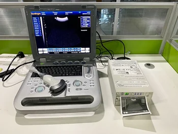 15-дюймовый светодиодный ультразвуковой аппарат для эхокардиографии сердца 3D 4D для ноутбука